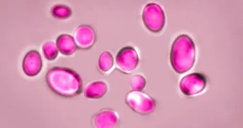 Texas dẫn đầu Hoa Kỳ về số ca nhiễm nấm Candida auris nguy hiểm