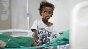 Nội Chiến Yemen Bùng Phát Trở Lại, Hệ Thống Y Tế Oằn Mình