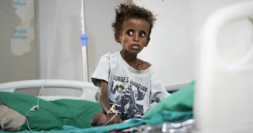 Nội Chiến Yemen Bùng Phát Trở Lại, Hệ Thống Y Tế Oằn Mình
