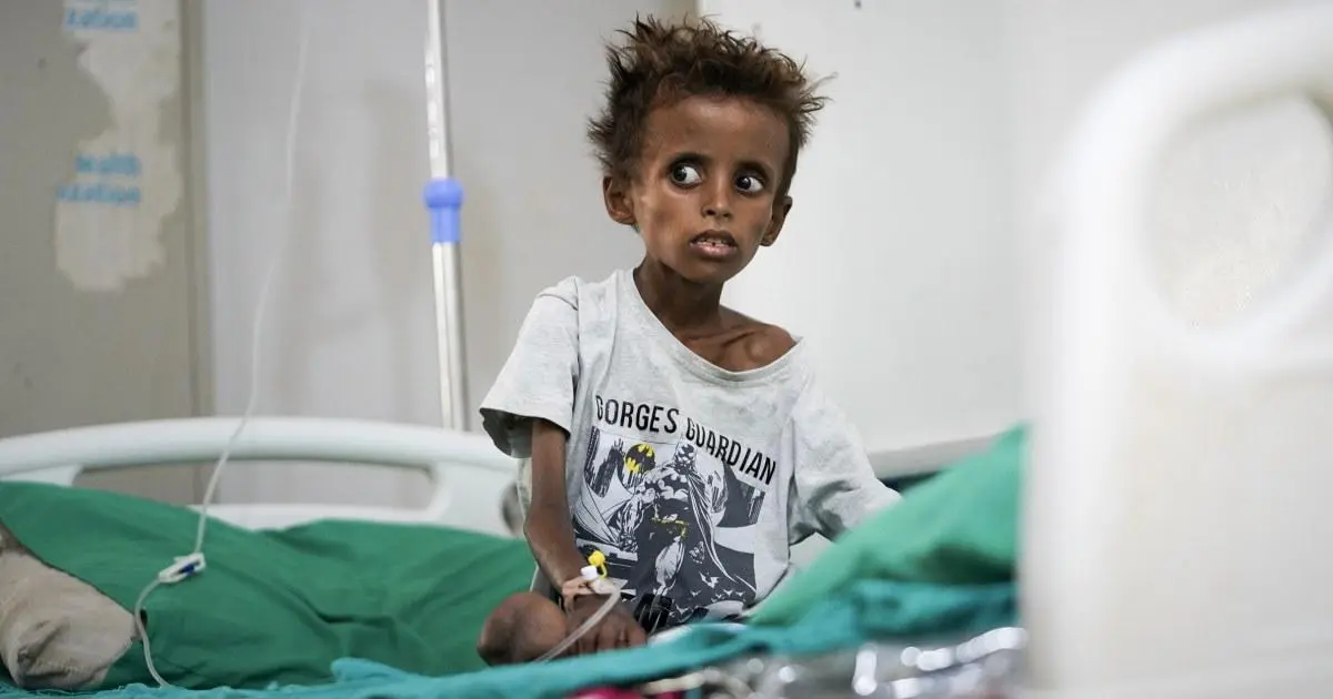 Nội Chiến Yemen Bùng Phát Trở Lại, Hệ Thống Y Tế Oằn Mình