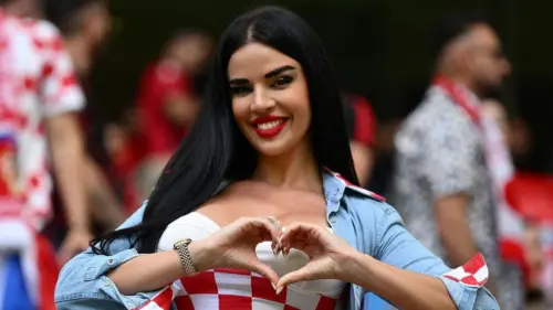 Siêu mẫu Ivana Knoll xuất hiện bên lề sân cỏ tại trận đấu của NFL