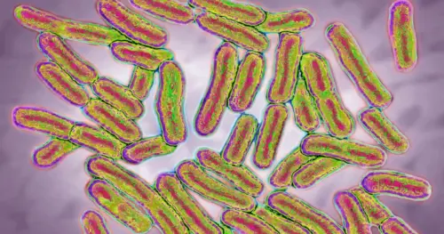 Sáu người chết, 30 người nhập viện vì ngộ độc thực phẩm do Salmonella