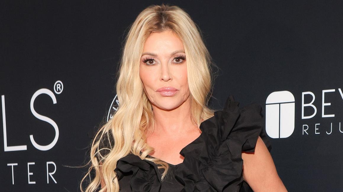 Brandi Glanville nói bác sĩ đang &#8220;lấy gương mặt của tôi&#8221; trong cuộc phẫu thuật thăm dò sau nhiều năm vấn đề sức khỏe