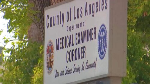 Phát hiện Legionella tại Trung tâm Giám định Y khoa Quận Los Angeles, một nhân viên dương tính